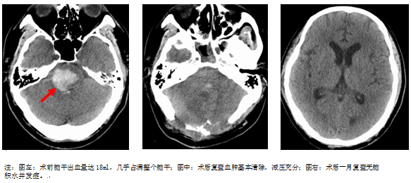 G:WeChat Fileswxid_s992ljny7q4n21FileStorageTempv0783826023.jpg